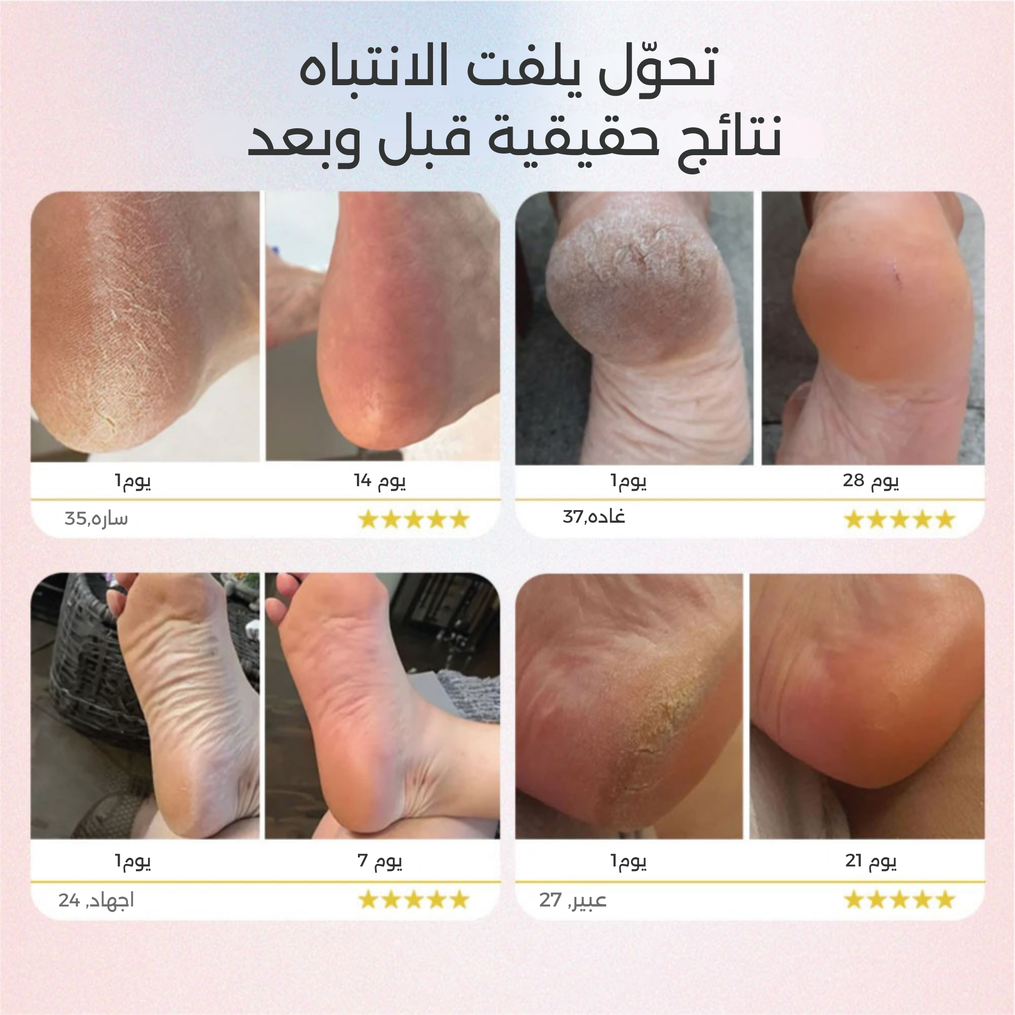 نغم™ – سرّ القدمين الناعمين